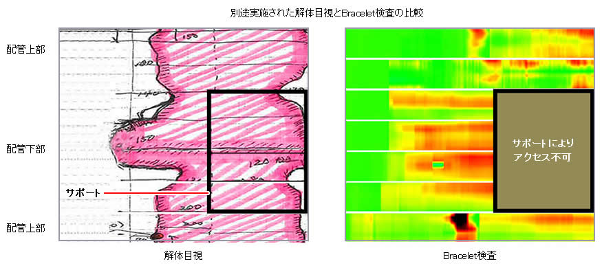 解体目視とBracelet検査の比較