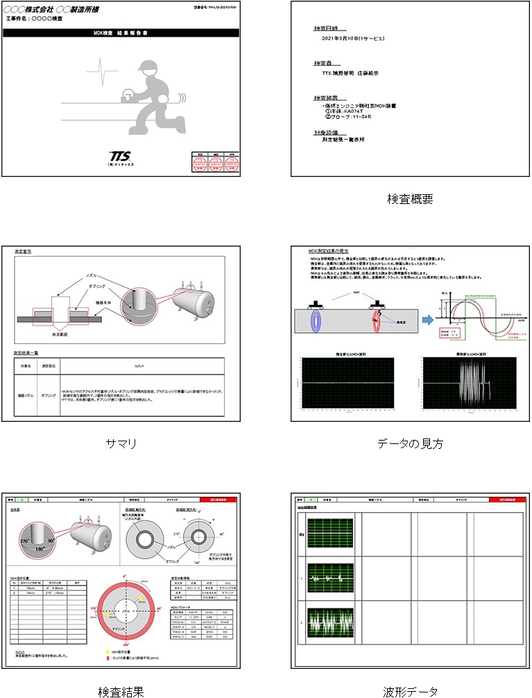 MDKの診断レポート